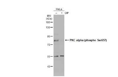 Western Blot: PKC alpha [p Ser657] Antibody [NBP3-13311] - Untreated (-) and treated (+) HeLa whole cell extracts (30 ug) were separated by 7.5% SDS-PAGE, and the membrane was blotted with PKC alpha (phospho Ser657) antibody (NBP3-13311) diluted at 1:500. The HRP-conjugated anti-rabbit IgG antibody (NBP2-19301) was used to detect the primary antibody, and the signal was developed with Trident ECL plus-Enhanced.